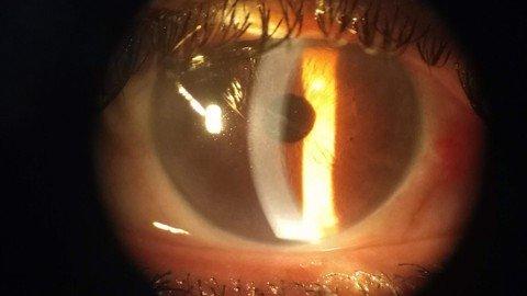 A Conceptual Understanding Of Clinical Ophthalmologylogy.jpg