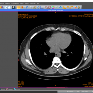 Sante DICOM Viewer Pro screen.png