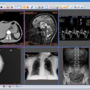 Sante DICOM Editor screen.jpg