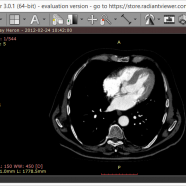 RadiAnt DICOM Viewer sc.png