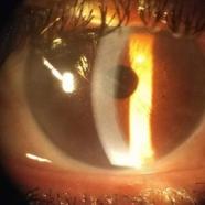 A Conceptual Understanding Of Clinical Ophthalmologylogy.jpg