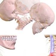 Physiotherapy Management Of Whiplash Injuries.jpg