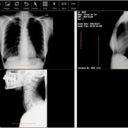 Fujidenolo Solutions SonicDICOM PACS sc.jpg